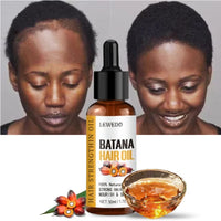 Batana Oil Hair Treatment